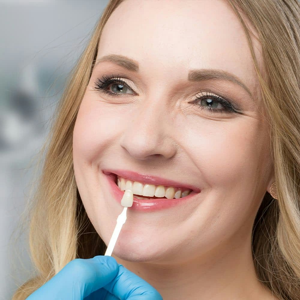Smiling veneers patient