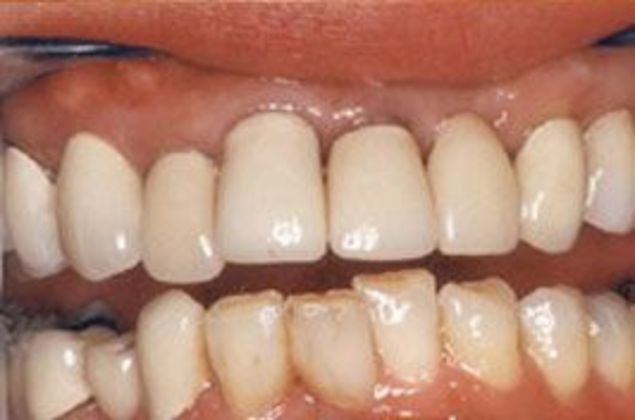 Before smile makeover