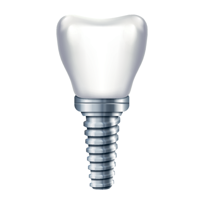 Illustration of a dental implant with a crown