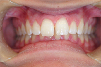 Before cosmetic treatment