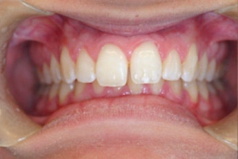 Before cosmetic treatment