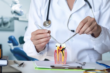 Root canal model