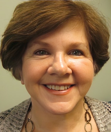 after facelift with Anya Kishinevsky, M.D.