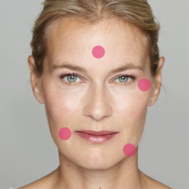 Mini facelift treatment area