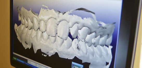 3D Model of teeth