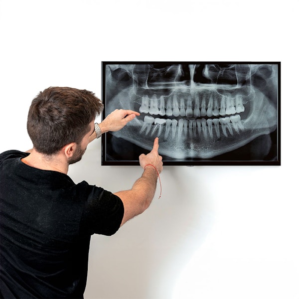 Dentist looking at an x-ray