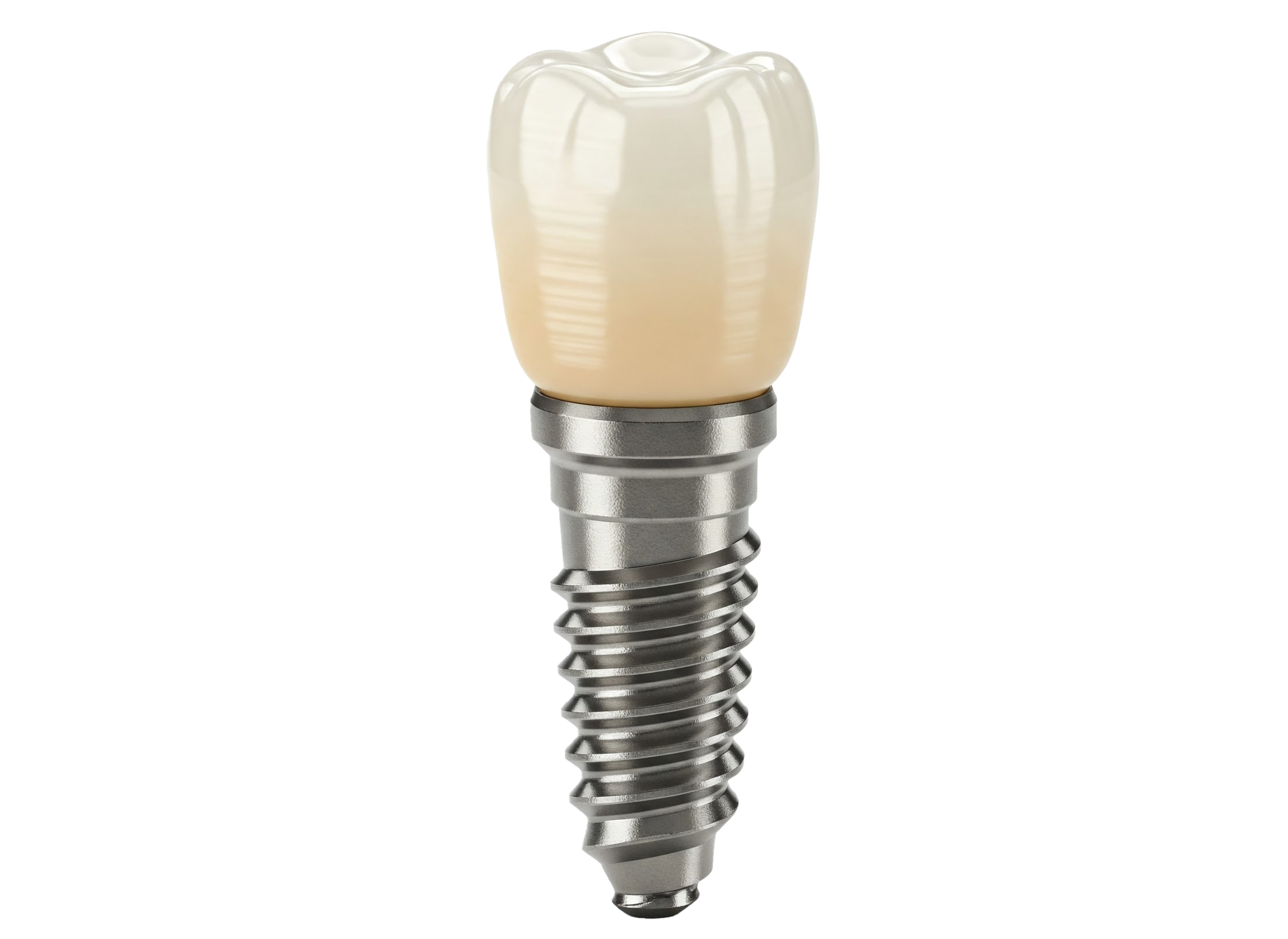 dental implant and crown
