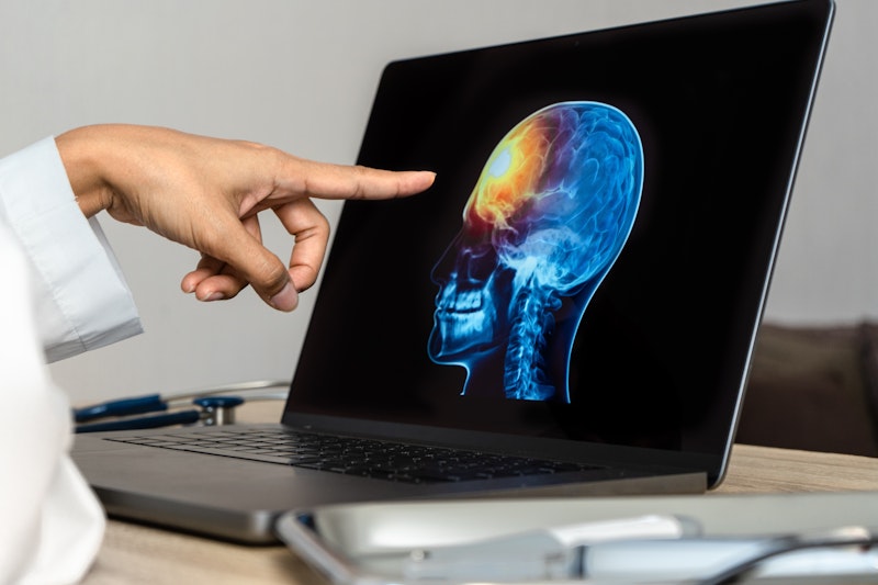 brain injury scan