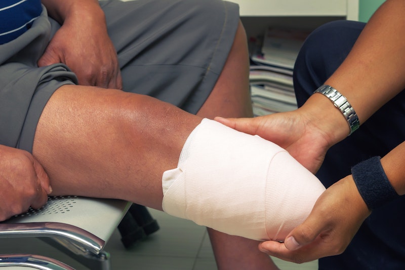 Doctor looking at an amputated leg