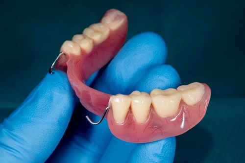 partial denture