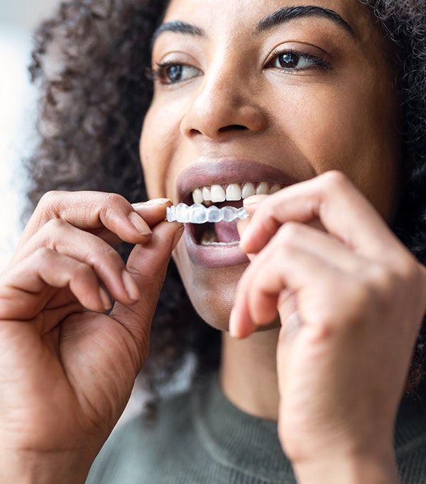 Woman placing Invisalign aligner over her teeth