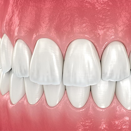 Closeup of a Woman's Smile