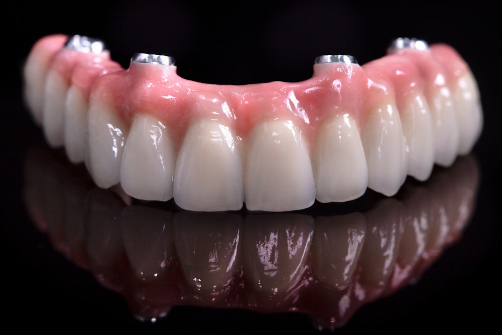 all-on-4 denture