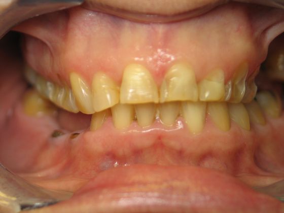 before smile makeover