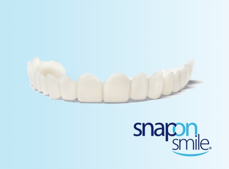 snap-on smile