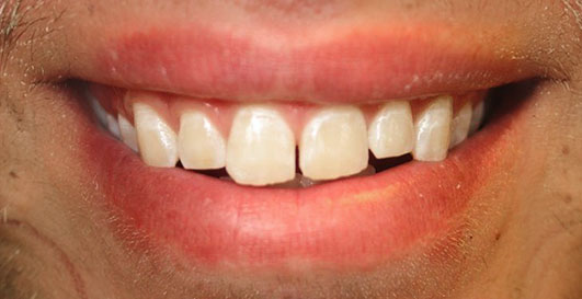 before dentistry photo