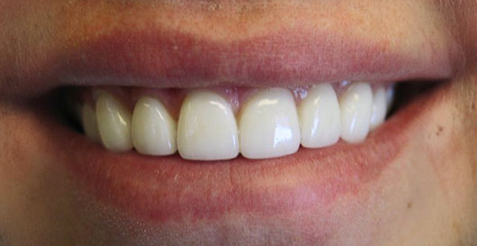 After dentistry photo