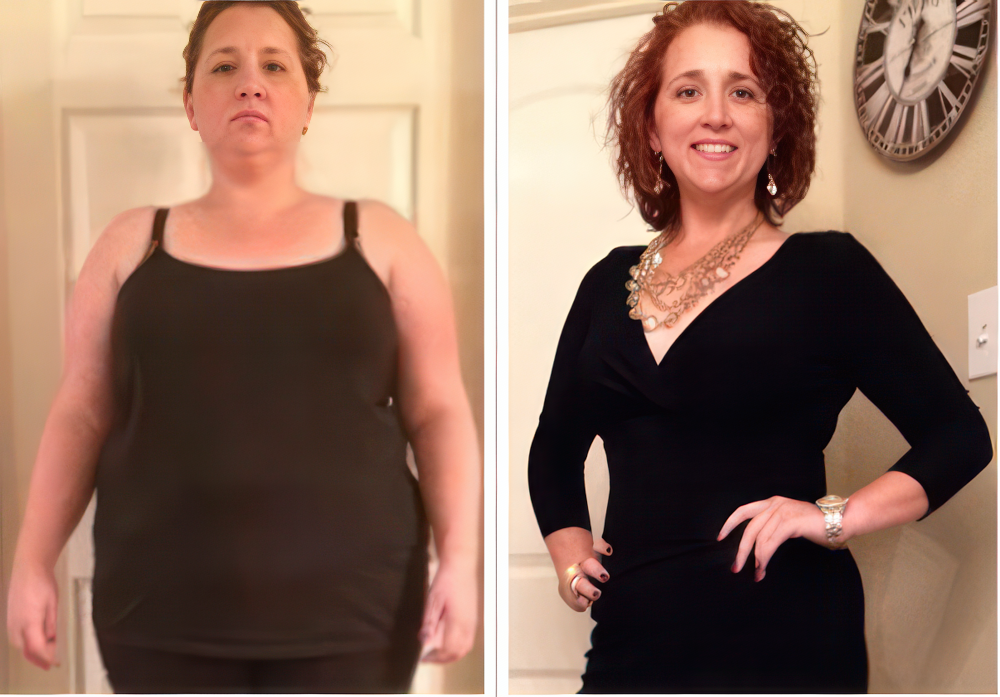 nutrition counseling patient before and after