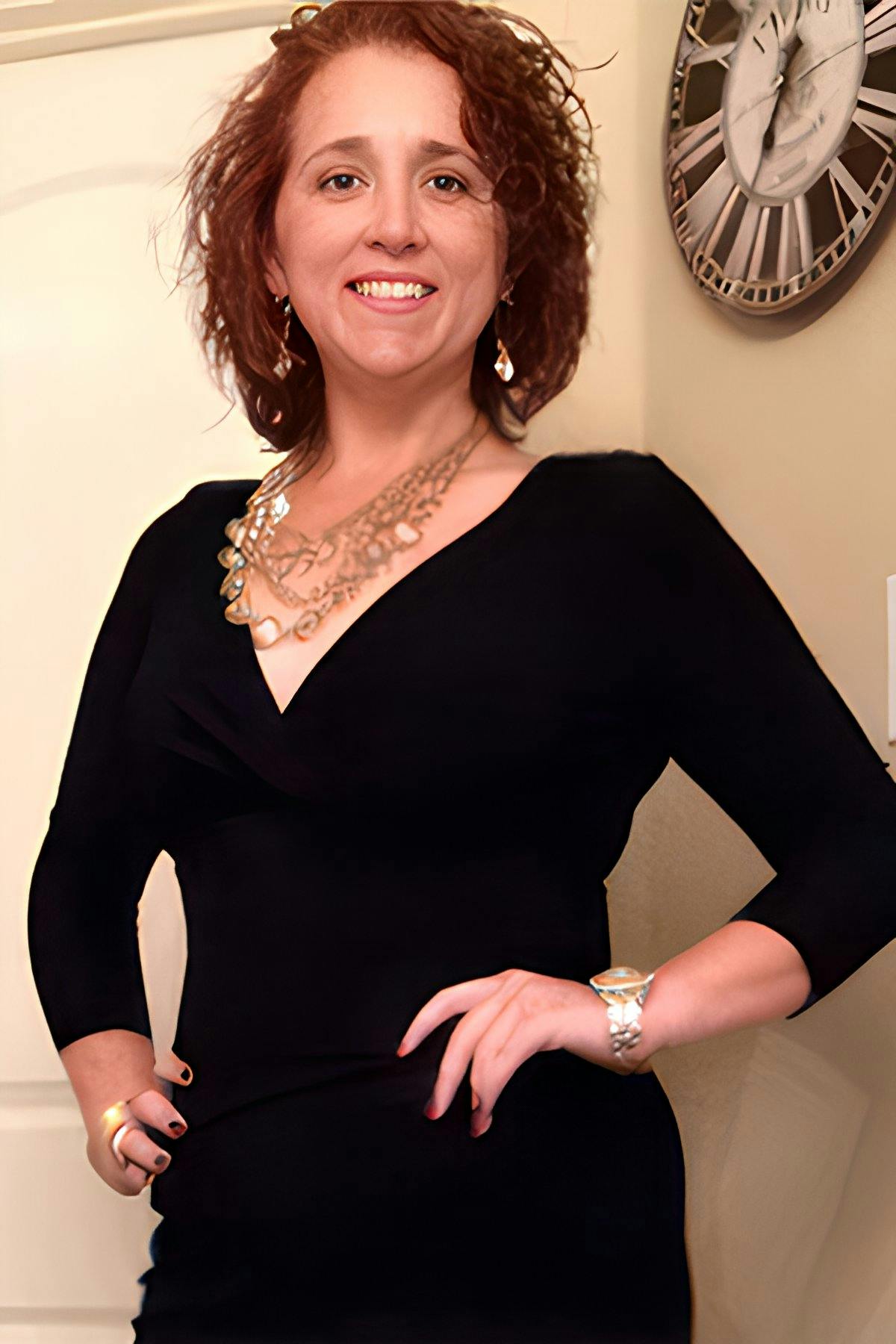 after gastric sleeve