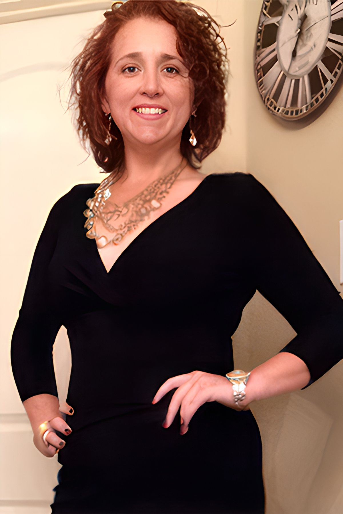 after gastric sleeve