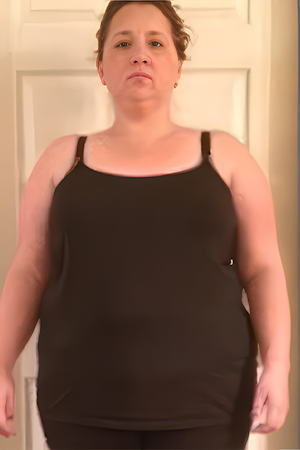 before gastric sleeve