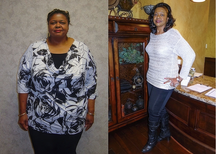 Dr. Matthew St. Laurent's patient before and after surgery