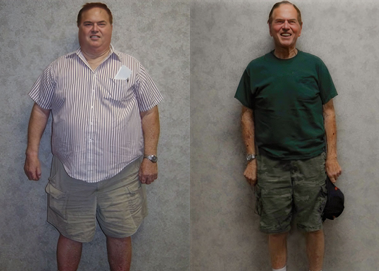 man before and after significant weight loss