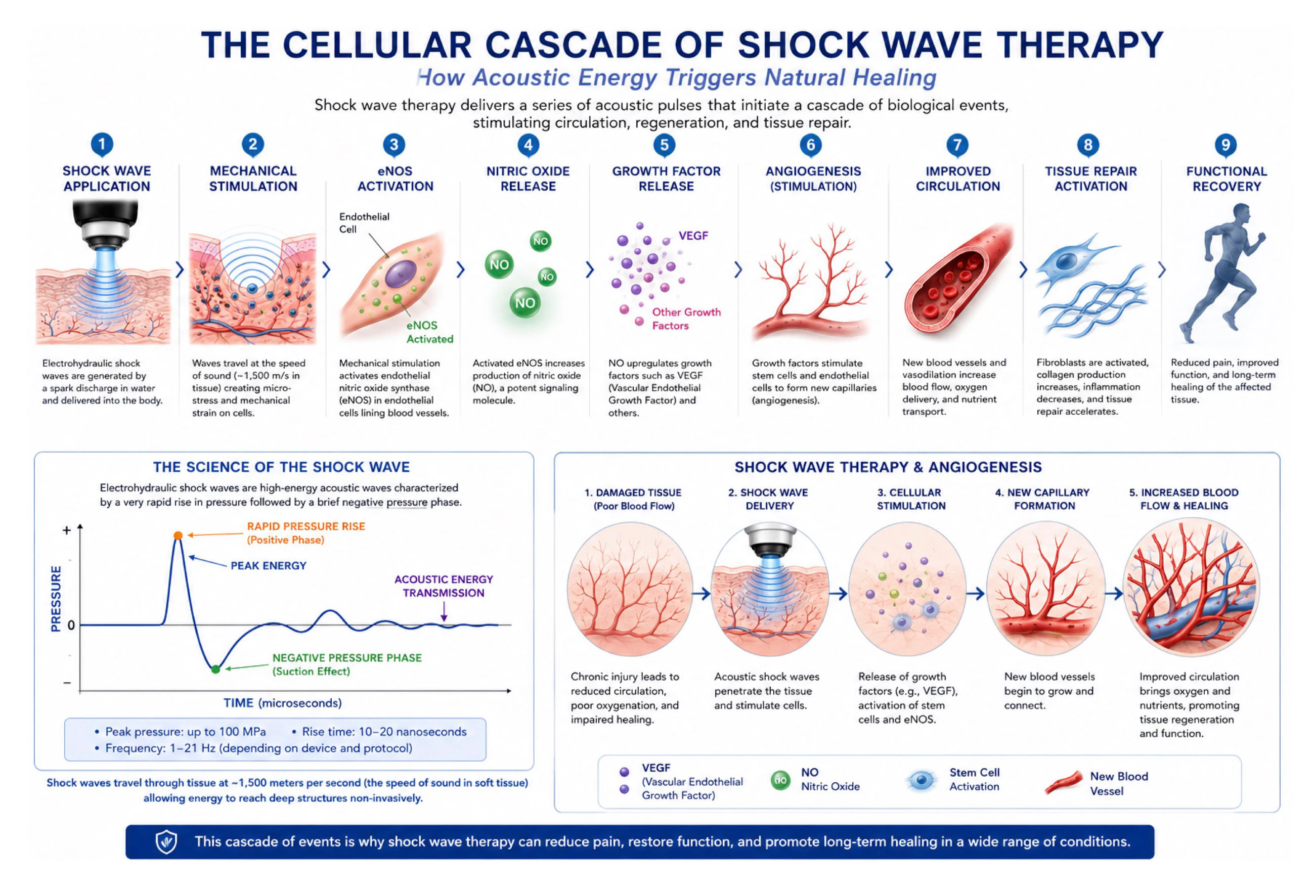 OMNIWave shock wave infographic