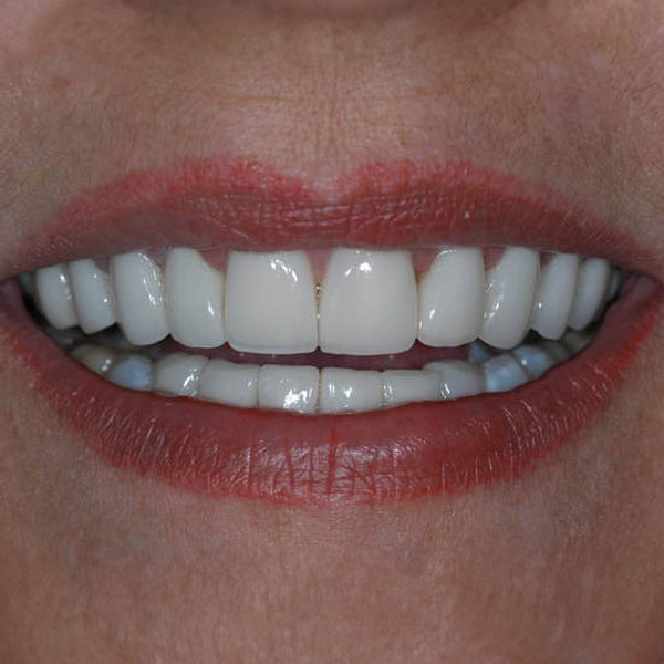 real patient results