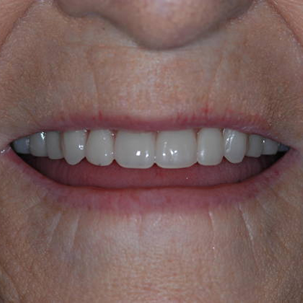 Real patient results