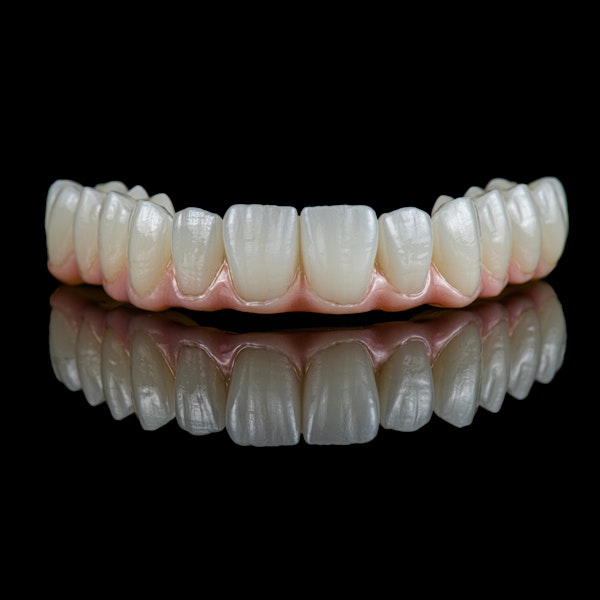 implant denture
