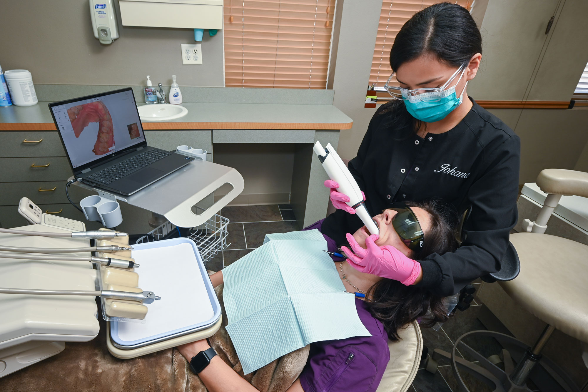 intraoral camera scan