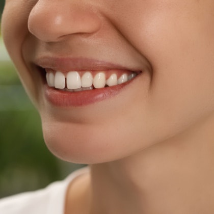 tooth gap in smile