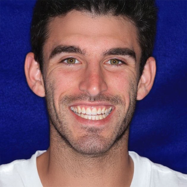 Man after dental bonding