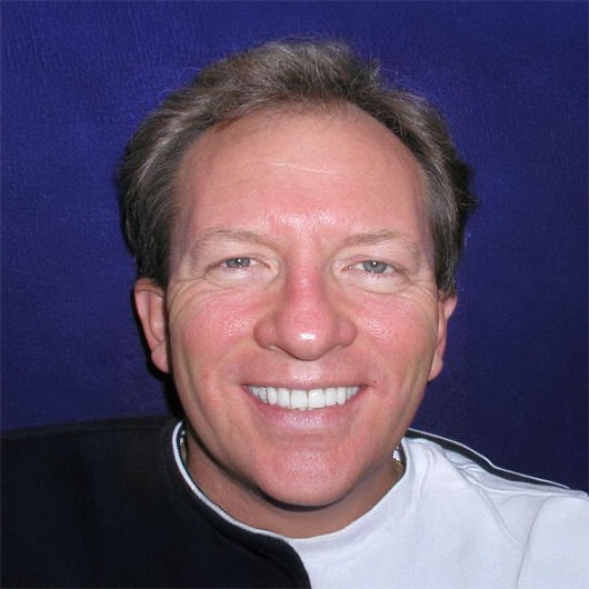 Man after custom smile makeover