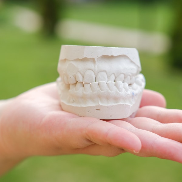 hand holding a model of a misaligned bite