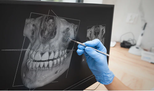 X-ray of person