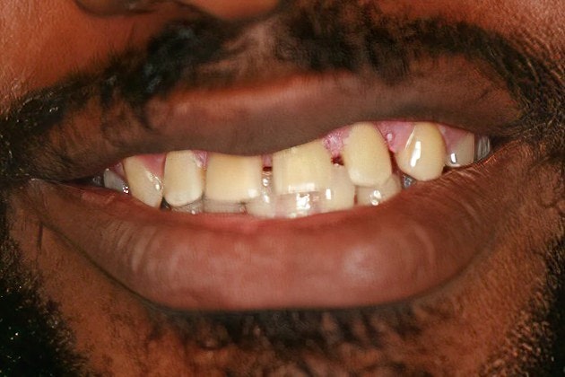 before dental care