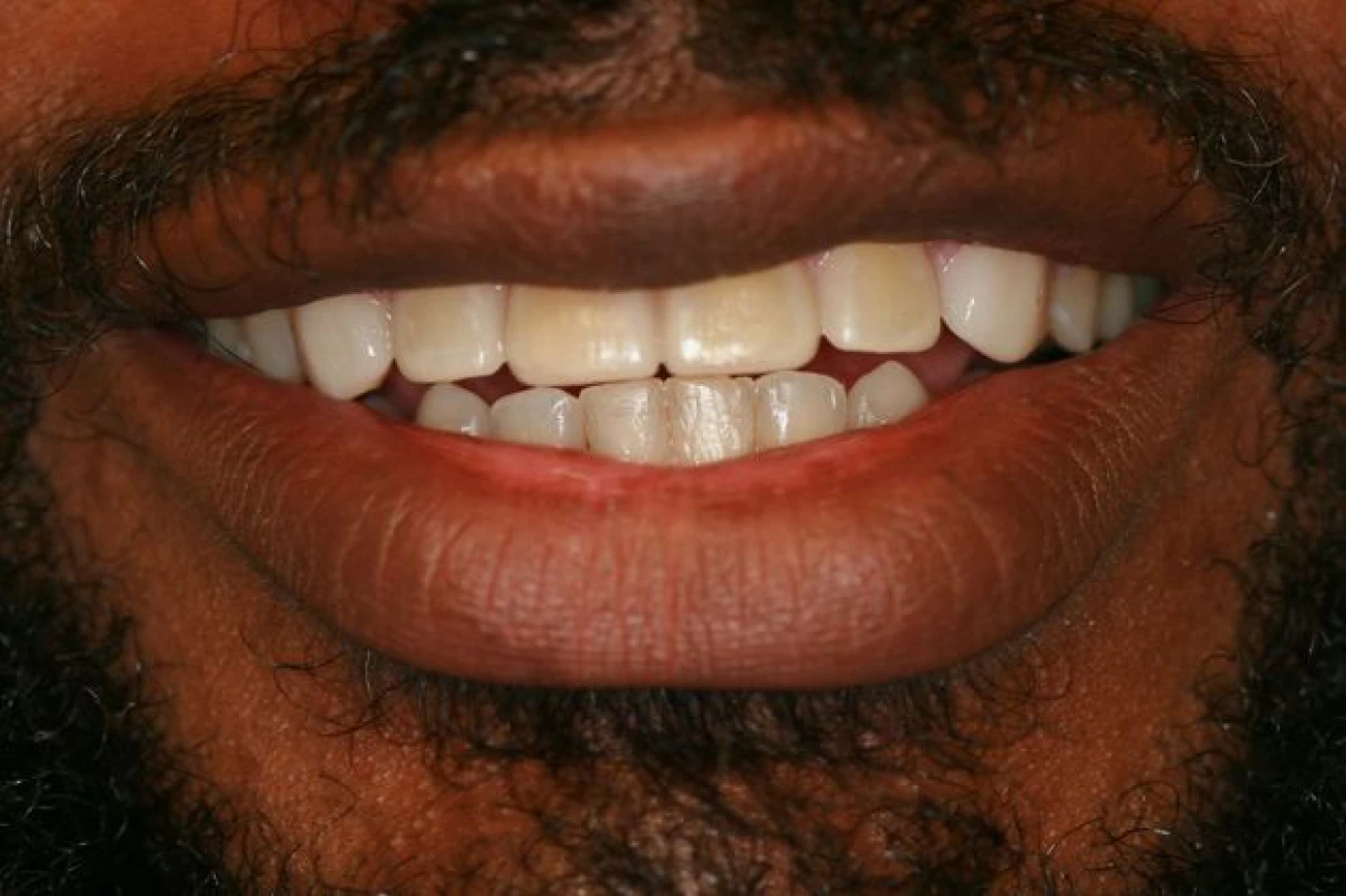Close up photo of real patient