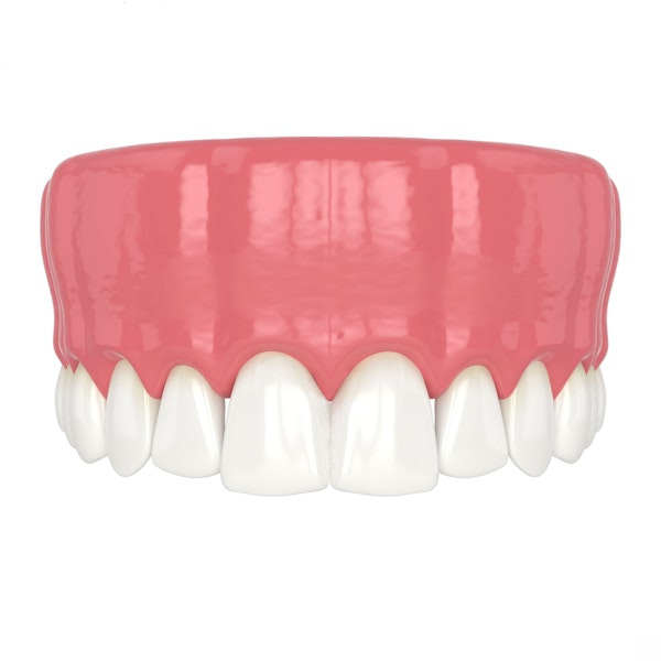 Full Mouth Reconstruction