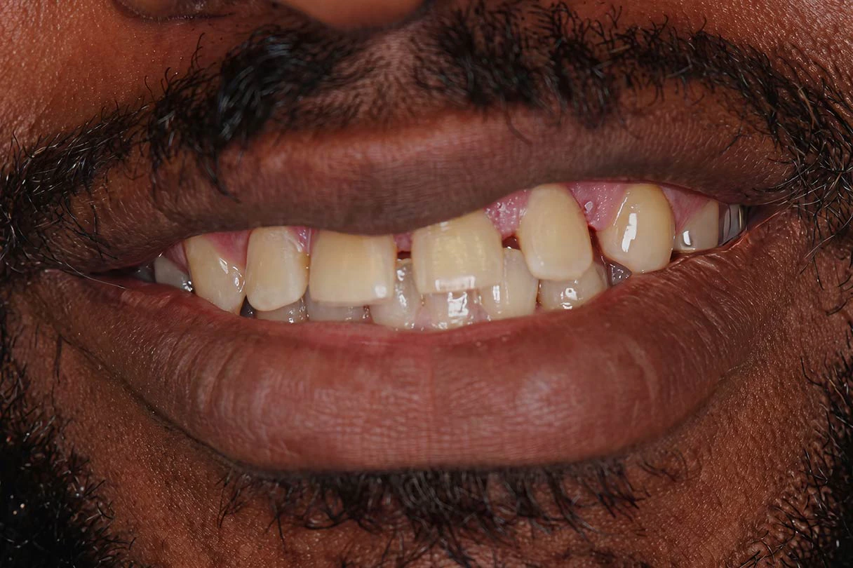 Close up photo of real patient