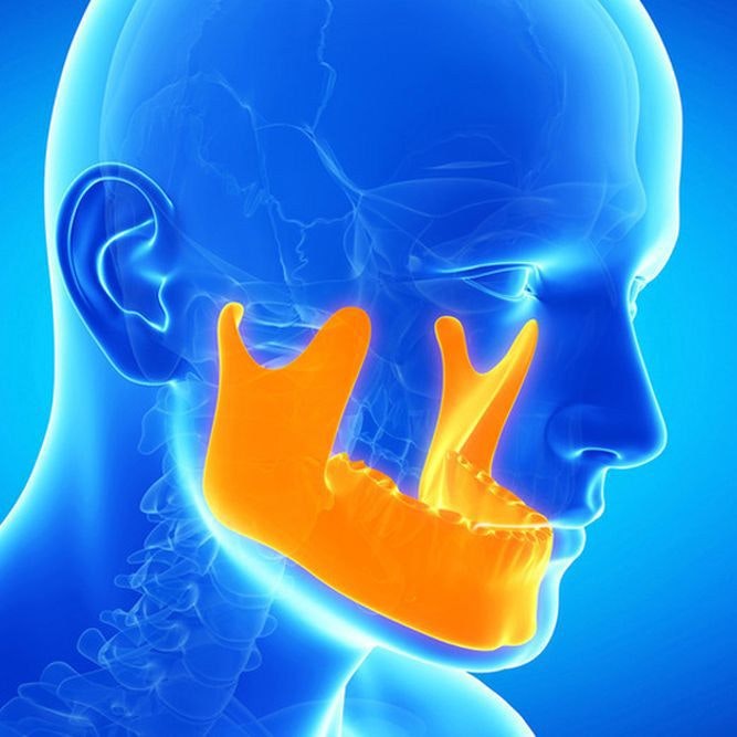 Illustration of sore jaw