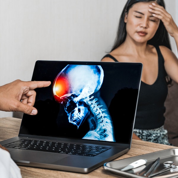 Woman rubbing head in pain and doctor looking at x-ray with red spot on skull