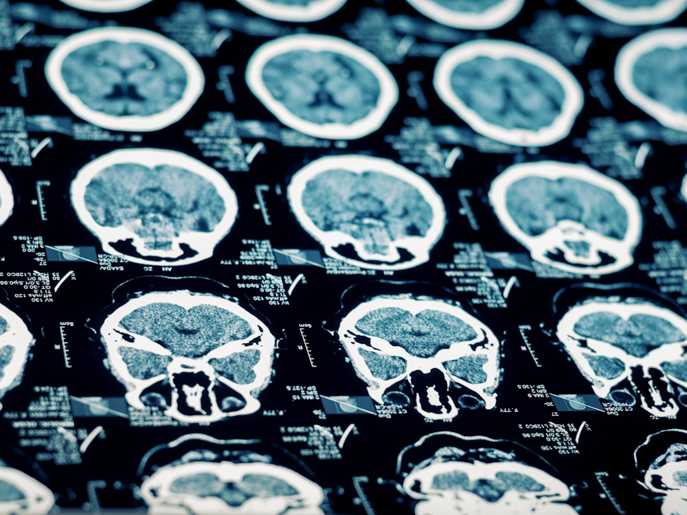 brain scans