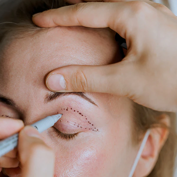 A clinician marks a woman