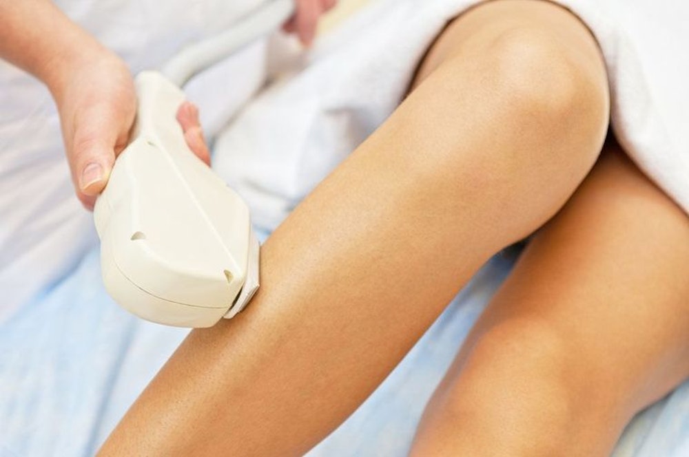 Female patient undergoing laser hair removal on her armpit