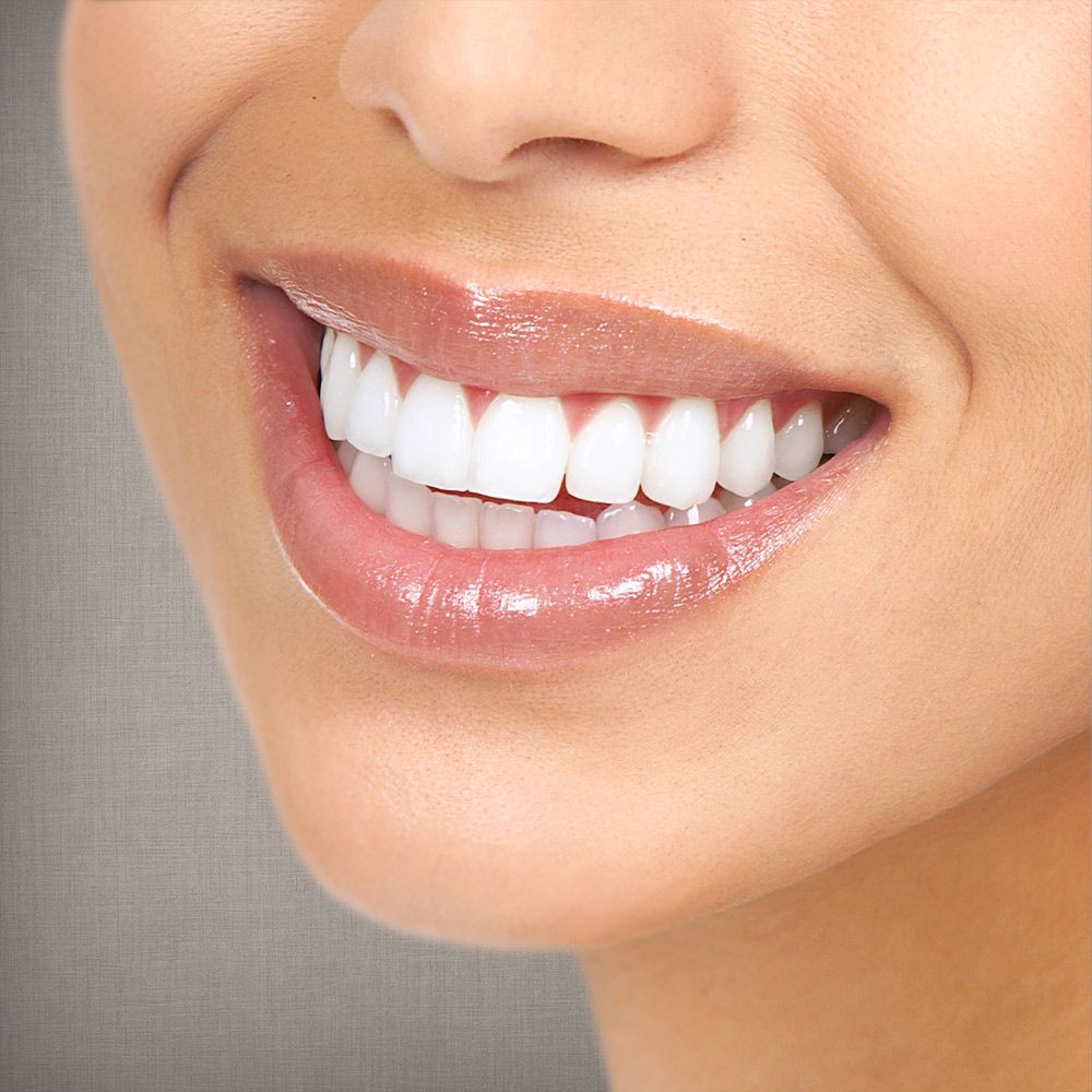 white teeth