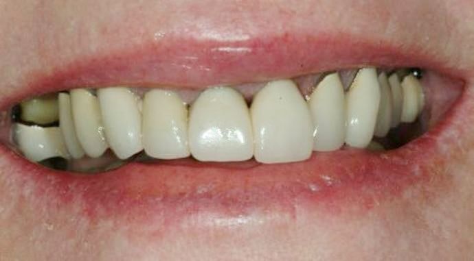 Before reconstruction