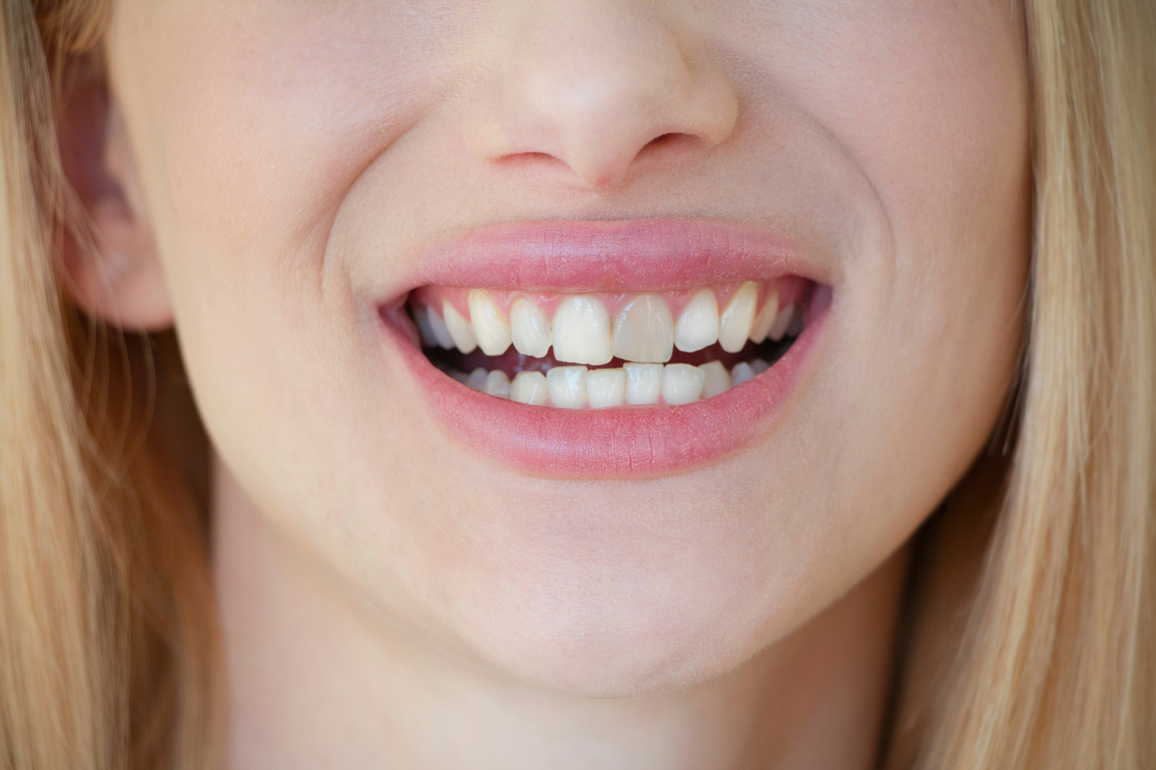woman with stained front tooth