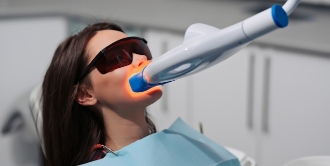 Professional teeth whitening